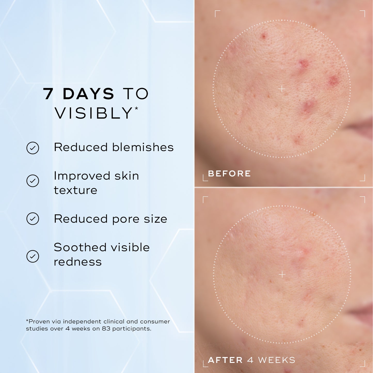 Peptides de niacinamide