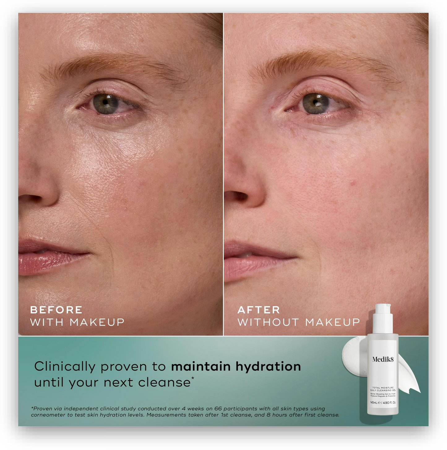 Total Moisture Daily Cleansing Gel