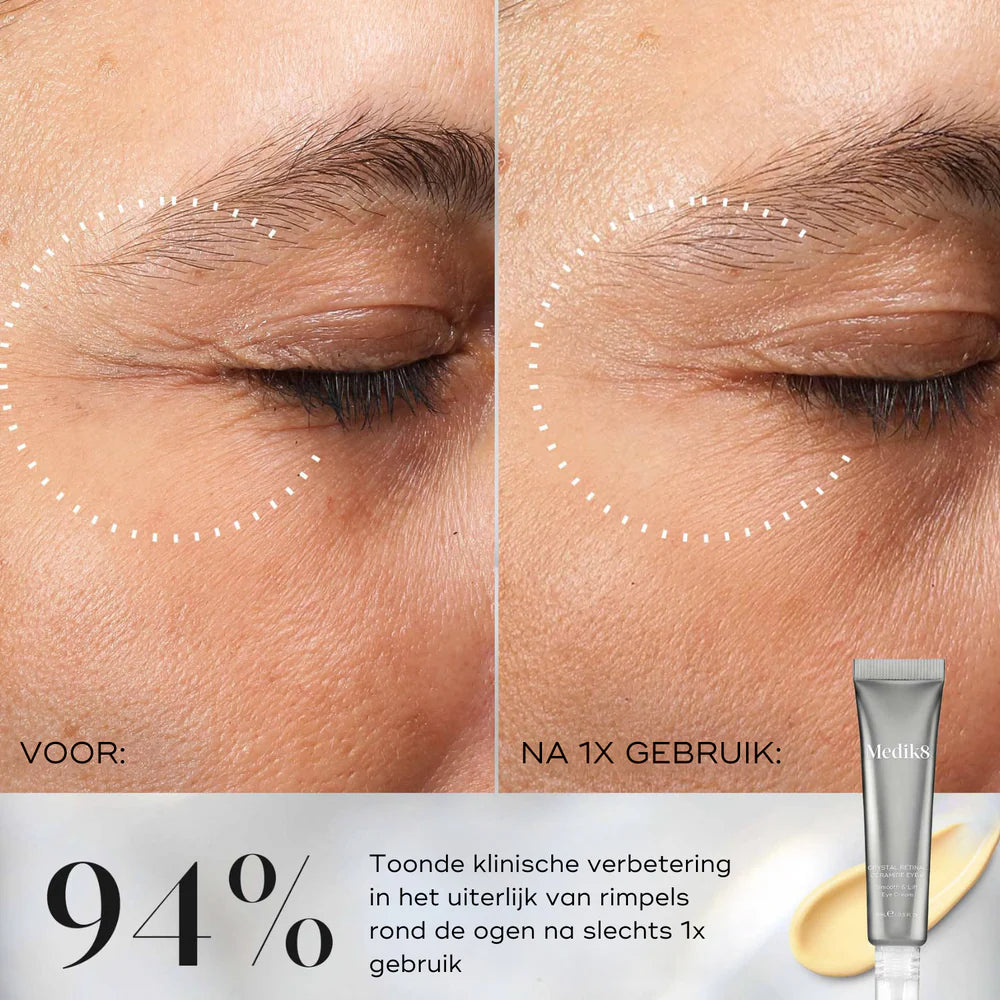 Crystal Retinal Ceramide Eye 3